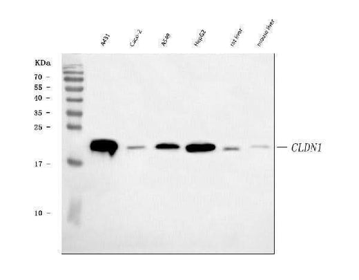 Anti-Claudin 1 CLDN1 Rabbit Monoclonal Antibody Boster Bio