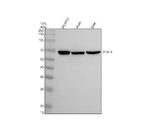 Anti-Parathyroid Hormone Receptor 1 Monoclonal Antibody Boster Bio