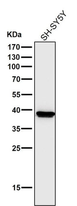 Anti-Cathepsin L/V/K/H Rabbit Monoclonal Antibody Boster Bio