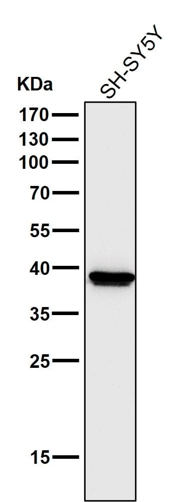 Anti-Cathepsin L/V/K/H Rabbit Monoclonal Antibody Boster Bio