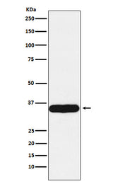Anti-Tropomyosin 1 Rabbit Monoclonal Antibody Boster Bio