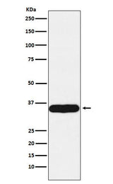 Anti-Tropomyosin 1 Rabbit Monoclonal Antibody Boster Bio