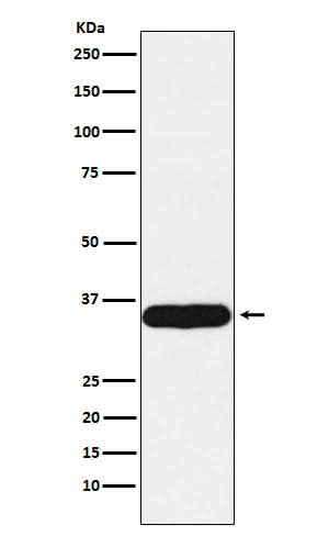 Anti-Tropomyosin 1 Rabbit Monoclonal Antibody Boster Bio