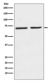 Anti-5HT2C Receptor Rabbit Monoclonal Antibody Boster Bio