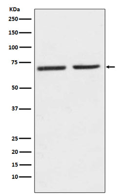 Anti-5HT2C Receptor Rabbit Monoclonal Antibody Boster Bio