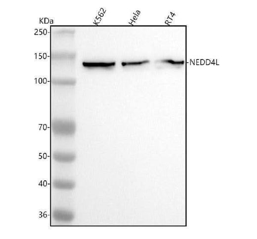 Anti-NEDD4-2 NEDD4L Rabbit Monoclonal Antibody Boster Bio