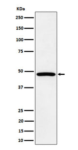 Anti-PTPN2 Rabbit Monoclonal Antibody Boster Bio