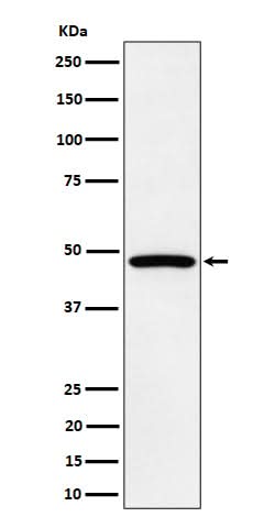 Anti-PTPN2 Rabbit Monoclonal Antibody Boster Bio