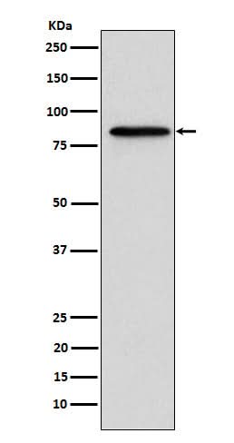 Anti-Gelsolin GSN Rabbit Monoclonal Antibody Boster Bio
