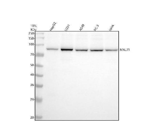 Anti-MALT1 Monoclonal Antibody Boster Bio
