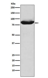 Anti-MALT1 Rabbit Monoclonal Antibody Boster Bio