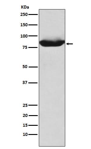 Anti-MALT1 Rabbit Monoclonal Antibody Boster Bio