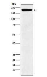 Anti-IQGAP1 Monoclonal Antibody Boster Bio