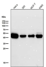 Anti-NEK2 Rabbit Monoclonal Antibody Boster Bio