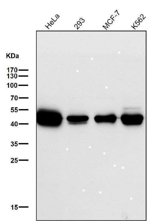 Anti-NEK2 Rabbit Monoclonal Antibody Boster Bio