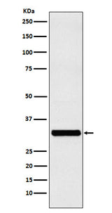 Anti-RAB27A Rabbit Monoclonal Antibody Boster Bio
