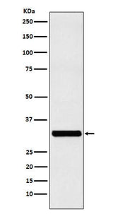 Anti-RAB27A Rabbit Monoclonal Antibody Boster Bio
