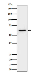 Anti-IKZF3 Rabbit Monoclonal Antibody Boster Bio