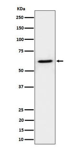 Anti-IKZF3 Rabbit Monoclonal Antibody Boster Bio