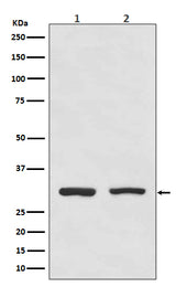 Anti-Bcl10 Rabbit Monoclonal Antibody Boster Bio