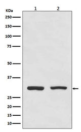 Anti-Bcl10 Rabbit Monoclonal Antibody Boster Bio
