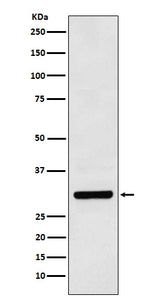 Anti-Bcl10 Rabbit Monoclonal Antibody Boster Bio
