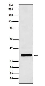 Anti-Bcl10 Rabbit Monoclonal Antibody Boster Bio