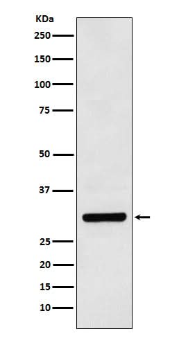 Anti-Bcl10 Rabbit Monoclonal Antibody Boster Bio
