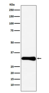 Anti-Bcl10 Rabbit Monoclonal Antibody Boster Bio