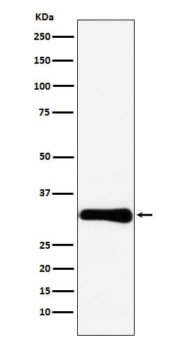 Anti-Bcl10 Rabbit Monoclonal Antibody Boster Bio