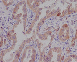 Anti-Catenin alpha 1 CTNNA1 Rabbit Monoclonal Antibody Boster Bio