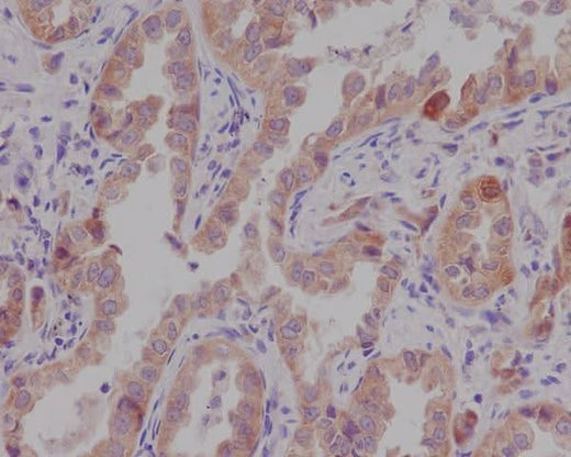 Anti-Catenin alpha 1 CTNNA1 Rabbit Monoclonal Antibody Boster Bio