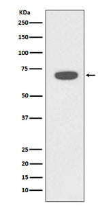 Anti-Rad18 Rabbit Monoclonal Antibody Boster Bio