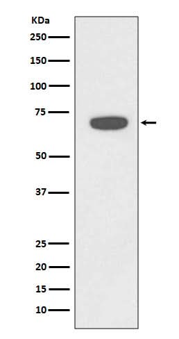 Anti-Rad18 Rabbit Monoclonal Antibody Boster Bio