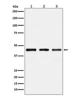 Anti-PGD Rabbit Monoclonal Antibody Boster Bio