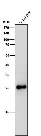 Anti-SNAP25 Rabbit Monoclonal Antibody Boster Bio