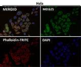 Anti-SNAP25 Rabbit Monoclonal Antibody Boster Bio