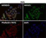 Anti-SNAP25 Rabbit Monoclonal Antibody Boster Bio