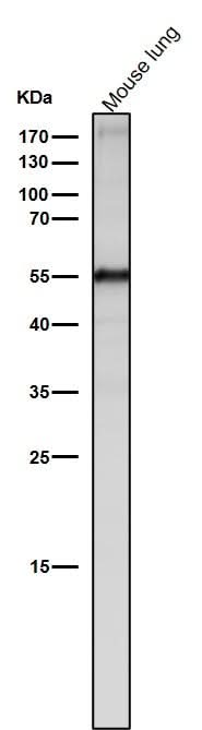 Anti-Slit2 Monoclonal Antibody Boster Bio