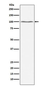 Anti-Dynamin 2 Monoclonal Antibody Boster Bio