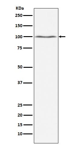 Anti-Dynamin 2 Monoclonal Antibody Boster Bio
