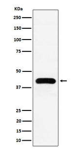 Anti-MVD Rabbit Monoclonal Antibody Boster Bio