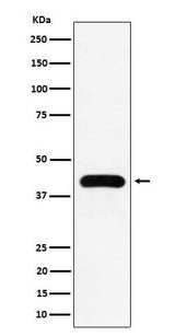 Anti-MVD Rabbit Monoclonal Antibody Boster Bio