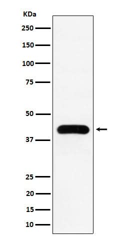 Anti-MVD Rabbit Monoclonal Antibody Boster Bio