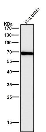 Anti-Cytokeratin 1 Rabbit Monoclonal Antibody Boster Bio