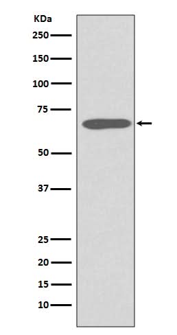 Anti-Cytokeratin 1 Rabbit Monoclonal Antibody Boster Bio