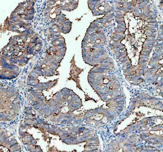 Anti-CA125 / MUC16 Monoclonal Antibody Boster Bio