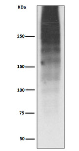 Anti-MUC16/Ca125 Rabbit Monoclonal Antibody Boster Bio