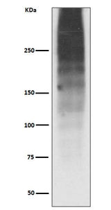Anti-MUC16/Ca125 Rabbit Monoclonal Antibody Boster Bio