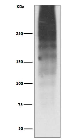 Anti-MUC16/Ca125 Rabbit Monoclonal Antibody Boster Bio